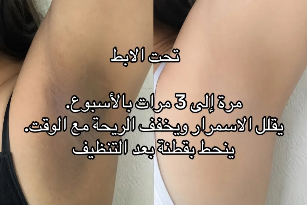 تونر الجلايكولك اسيد من اوردنري